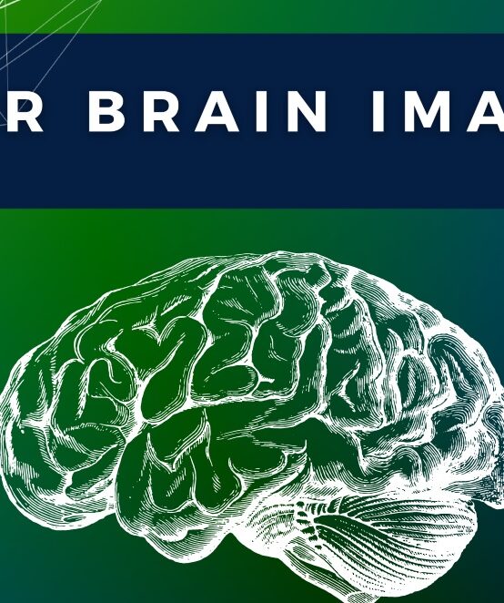 AI for Brain Imaging